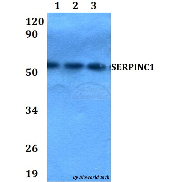 Anti-SERPINC1 Antibody from Bioworld Technology (BS60662) - Antibodies.com