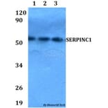 Anti-SERPINC1 Antibody from Bioworld Technology (BS60662) - Antibodies.com