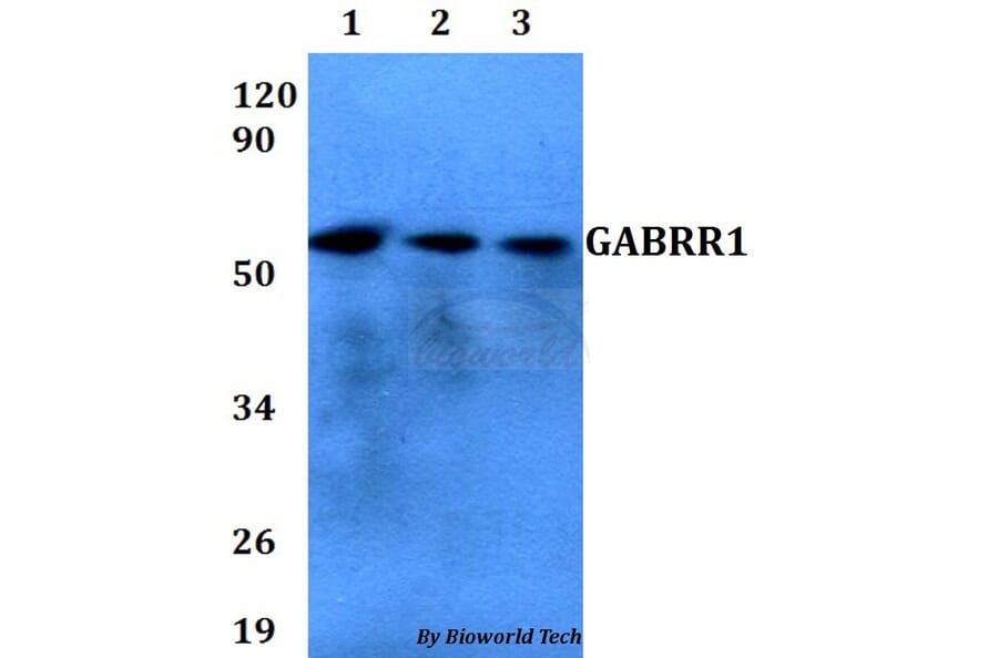 Anti-GABRR1 Antibody from Bioworld Technology (BS60666) - Antibodies.com