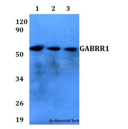 Anti-GABRR1 Antibody from Bioworld Technology (BS60666) - Antibodies.com