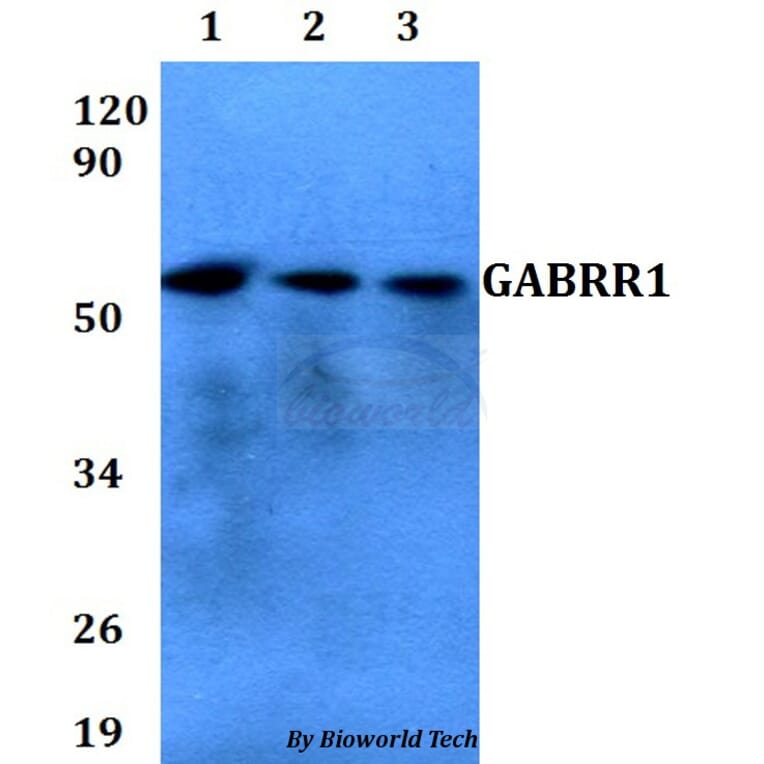 Anti-GABRR1 Antibody from Bioworld Technology (BS60666) - Antibodies.com