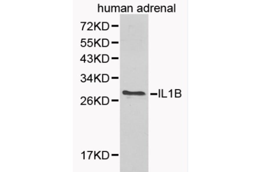 Anti-IL-1β Antibody from Bioworld Technology (BS6067) - Antibodies.com