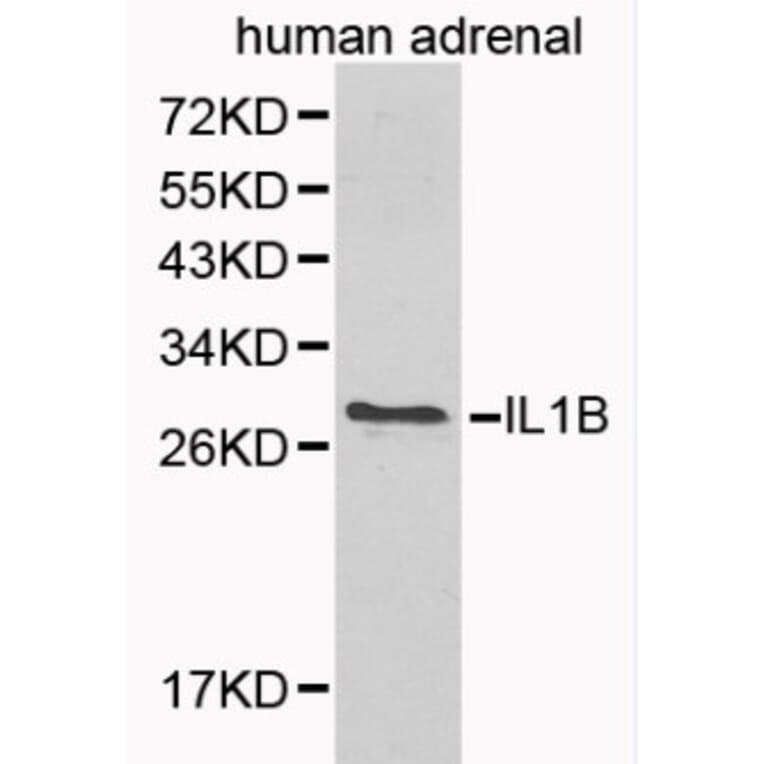 Anti-IL-1β Antibody from Bioworld Technology (BS6067) - Antibodies.com