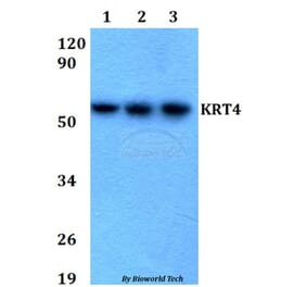 Anti-KRT4 Antibody from Bioworld Technology (BS60671) - Antibodies.com