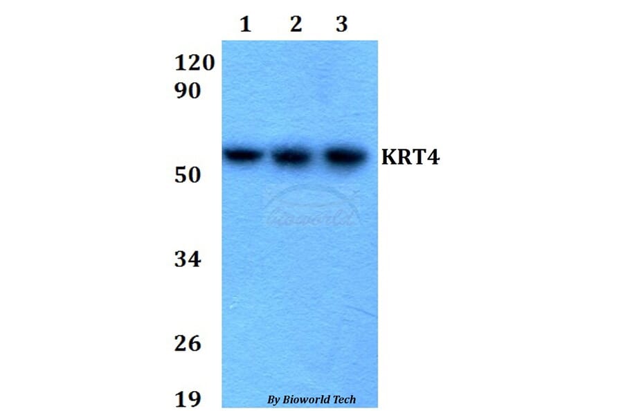 Anti-KRT4 Antibody from Bioworld Technology (BS60671) - Antibodies.com