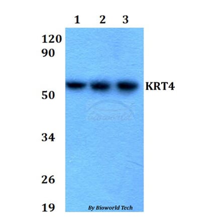 Anti-KRT4 Antibody from Bioworld Technology (BS60671) - Antibodies.com