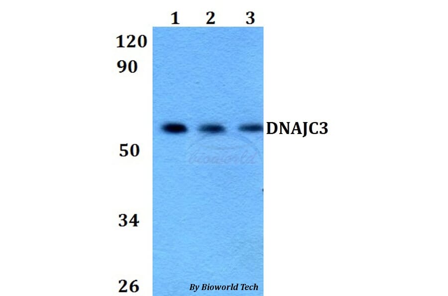 Anti-DNAJC3 Antibody from Bioworld Technology (BS60672) - Antibodies.com