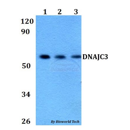 Anti-DNAJC3 Antibody from Bioworld Technology (BS60672) - Antibodies.com