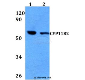 Anti-CYP11B2 Antibody from Bioworld Technology (BS60673) - Antibodies.com