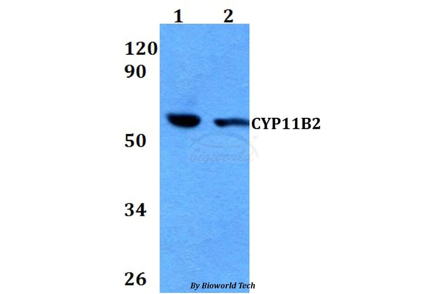 Anti-CYP11B2 Antibody from Bioworld Technology (BS60673) - Antibodies.com