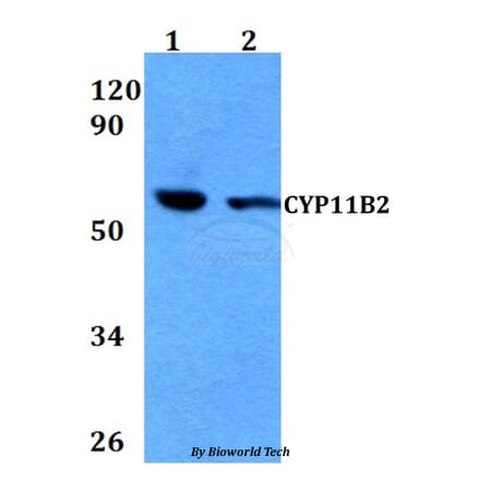 Anti-CYP11B2 Antibody from Bioworld Technology (BS60673) - Antibodies.com