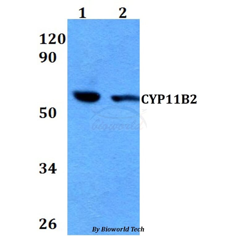 Anti-CYP11B2 Antibody from Bioworld Technology (BS60673) - Antibodies.com