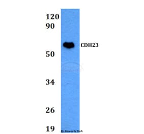 Anti-CDH23 Antibody from Bioworld Technology (BS60676) - Antibodies.com