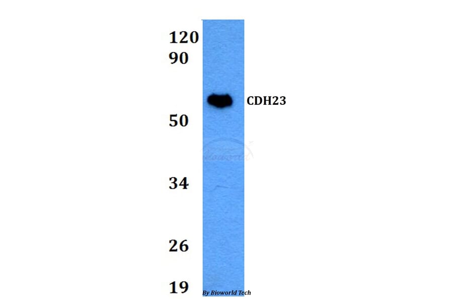 Anti-CDH23 Antibody from Bioworld Technology (BS60676) - Antibodies.com