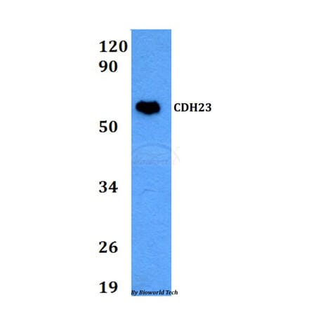 Anti-CDH23 Antibody from Bioworld Technology (BS60676) - Antibodies.com