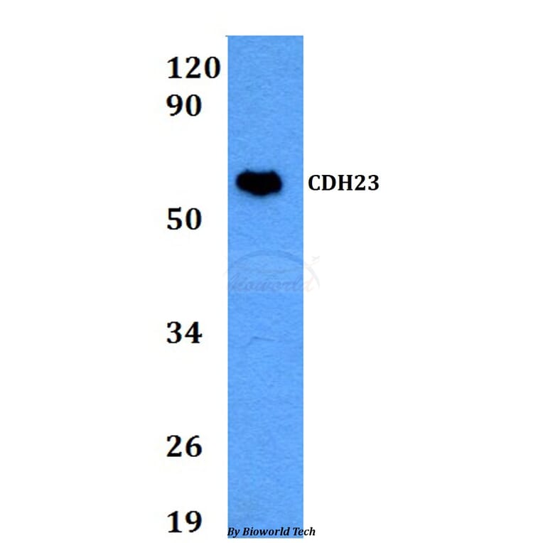 Anti-CDH23 Antibody from Bioworld Technology (BS60676) - Antibodies.com
