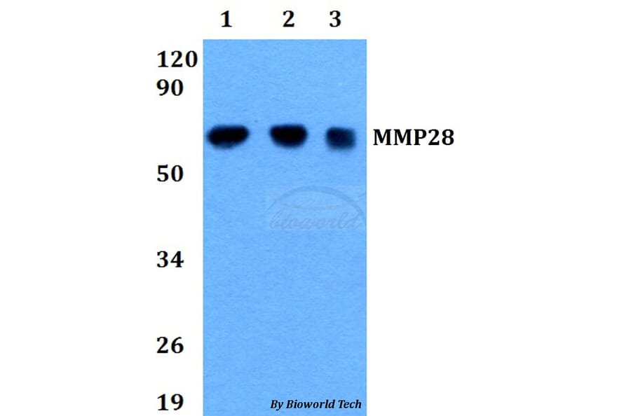 Anti-MMP28 Antibody from Bioworld Technology (BS60677) - Antibodies.com