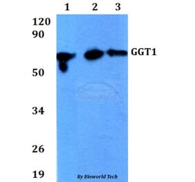 Anti-GGT1 Antibody from Bioworld Technology (BS60682) - Antibodies.com