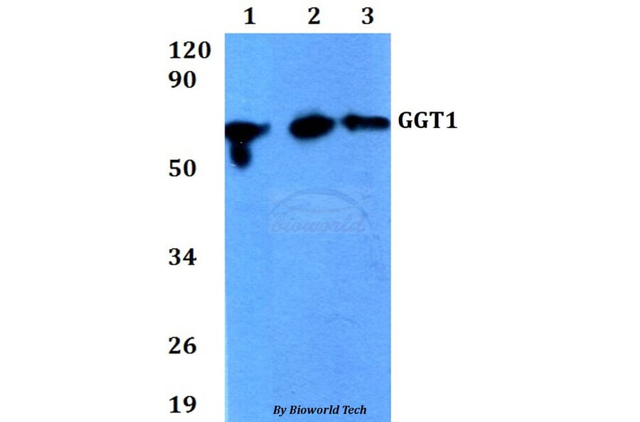 Anti-GGT1 Antibody from Bioworld Technology (BS60682) - Antibodies.com