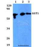 Anti-GGT1 Antibody from Bioworld Technology (BS60682) - Antibodies.com
