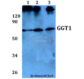 Anti-GGT1 Antibody from Bioworld Technology (BS60683) - Antibodies.com
