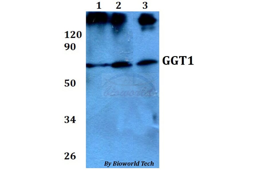 Anti-GGT1 Antibody from Bioworld Technology (BS60683) - Antibodies.com