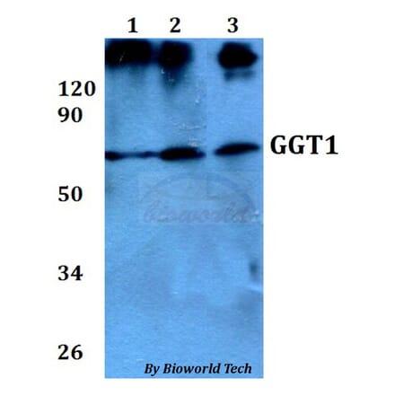 Anti-GGT1 Antibody from Bioworld Technology (BS60683) - Antibodies.com