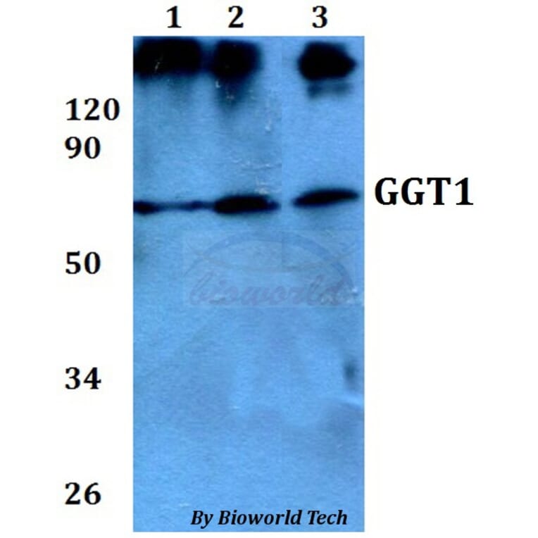 Anti-GGT1 Antibody from Bioworld Technology (BS60683) - Antibodies.com
