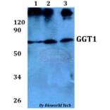 Anti-GGT1 Antibody from Bioworld Technology (BS60683) - Antibodies.com