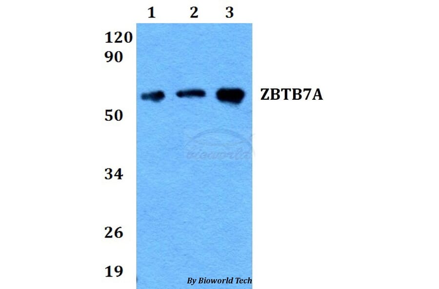 Anti-ZBTB7A Antibody from Bioworld Technology (BS60685) - Antibodies.com