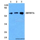 Anti-ZBTB7A Antibody from Bioworld Technology (BS60685) - Antibodies.com