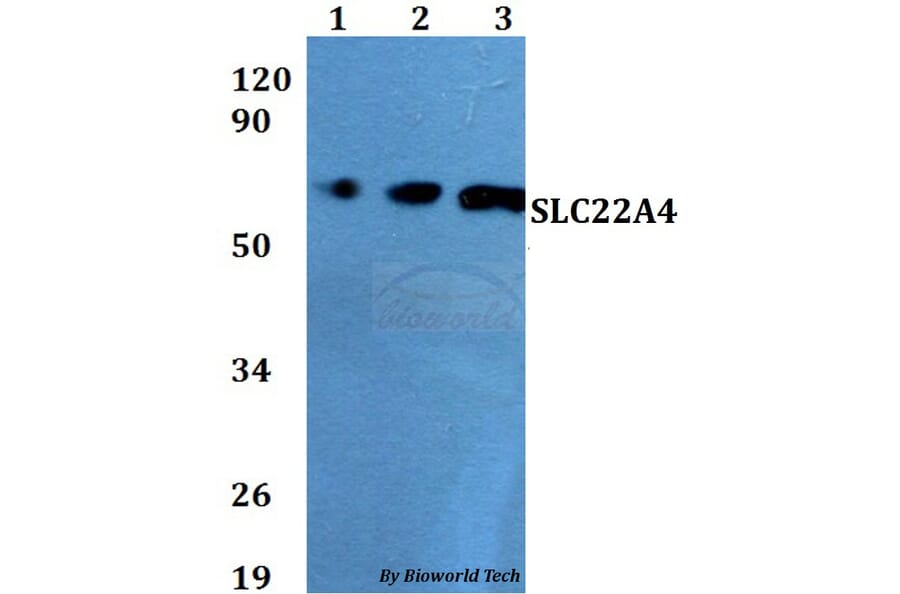 Anti-SLC22A4 Antibody from Bioworld Technology (BS60686) - Antibodies.com