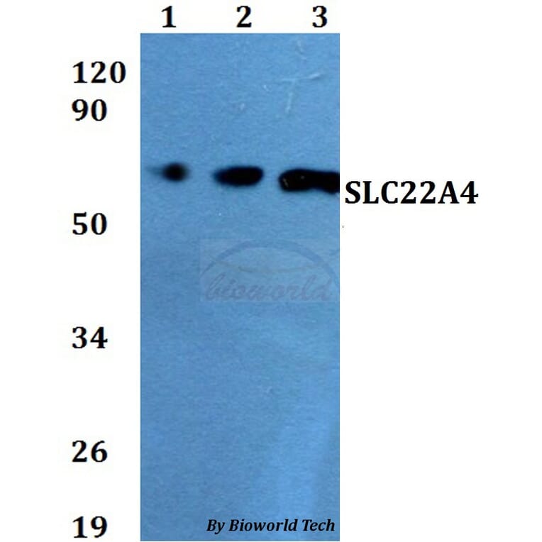 Anti-SLC22A4 Antibody from Bioworld Technology (BS60686) - Antibodies.com