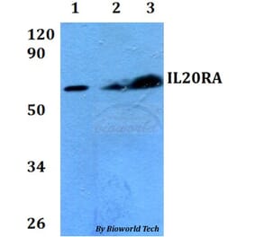 Anti-IL20RA Antibody from Bioworld Technology (BS60687) - Antibodies.com