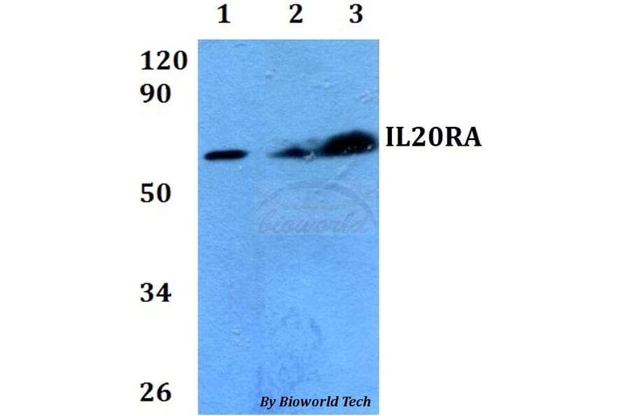 Anti-IL20RA Antibody from Bioworld Technology (BS60687) - Antibodies.com