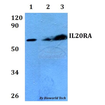 Anti-IL20RA Antibody from Bioworld Technology (BS60687) - Antibodies.com