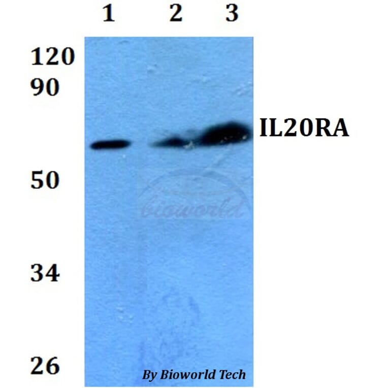 Anti-IL20RA Antibody from Bioworld Technology (BS60687) - Antibodies.com