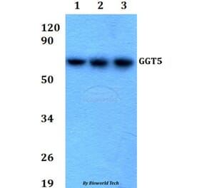 Anti-GGT5 Antibody from Bioworld Technology (BS60688) - Antibodies.com