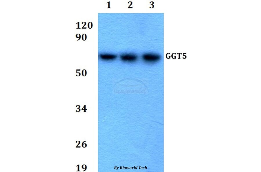Anti-GGT5 Antibody from Bioworld Technology (BS60688) - Antibodies.com