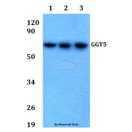 Anti-GGT5 Antibody from Bioworld Technology (BS60688) - Antibodies.com