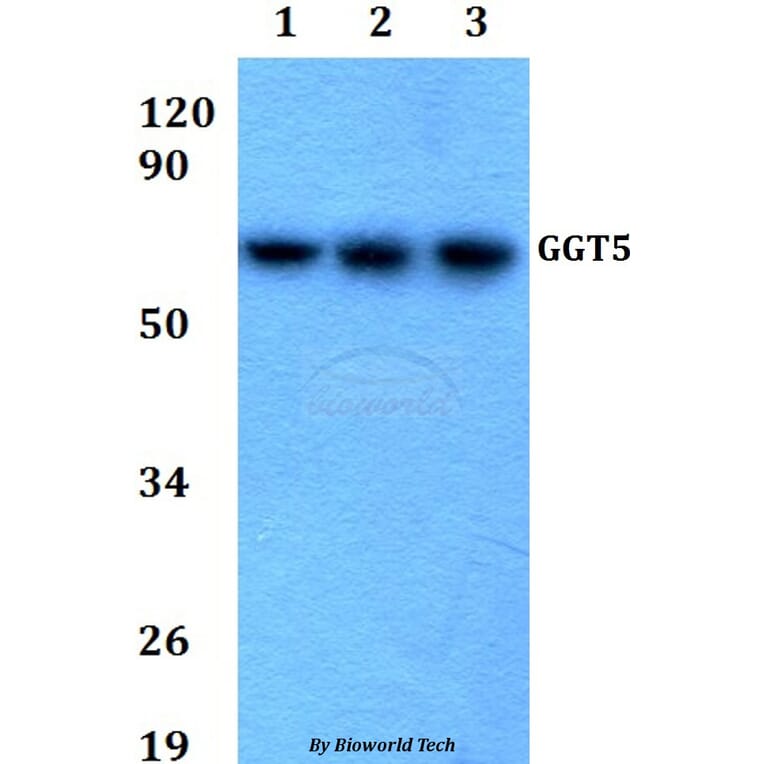 Anti-GGT5 Antibody from Bioworld Technology (BS60688) - Antibodies.com