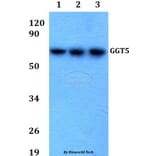 Anti-GGT5 Antibody from Bioworld Technology (BS60688) - Antibodies.com