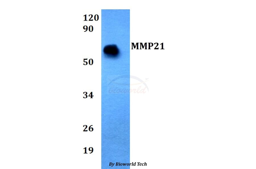 Anti-MMP21 Antibody from Bioworld Technology (BS60692) - Antibodies.com