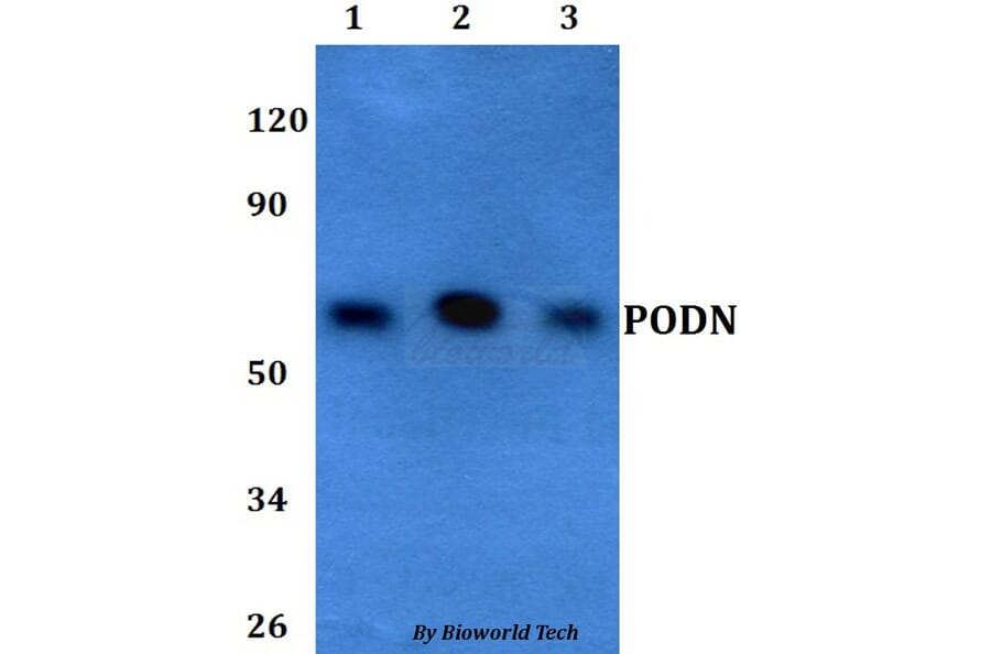 Anti-PODN Antibody from Bioworld Technology (BS60696) - Antibodies.com