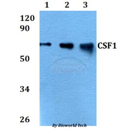Anti-CSF1 Antibody from Bioworld Technology (BS60697) - Antibodies.com