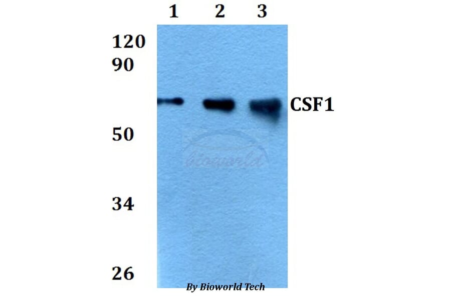 Anti-CSF1 Antibody from Bioworld Technology (BS60697) - Antibodies.com