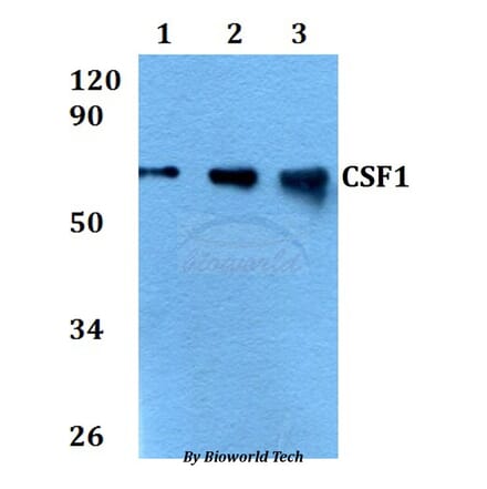 Anti-CSF1 Antibody from Bioworld Technology (BS60697) - Antibodies.com