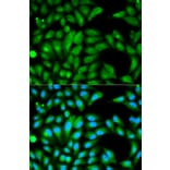 Anti-PARK2 Antibody from Bioworld Technology (BS6071) - Antibodies.com