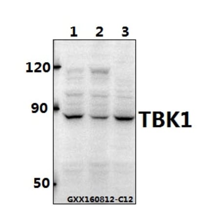 Anti-TBK1 Antibody from Bioworld Technology (BS60714) - Antibodies.com