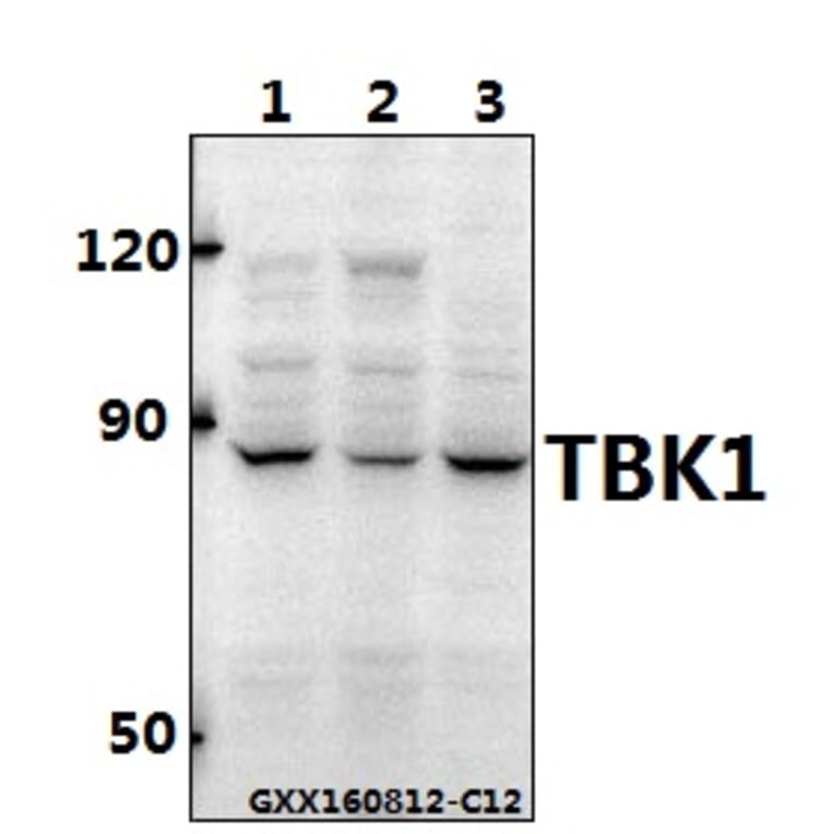 Anti-TBK1 Antibody from Bioworld Technology (BS60714) - Antibodies.com